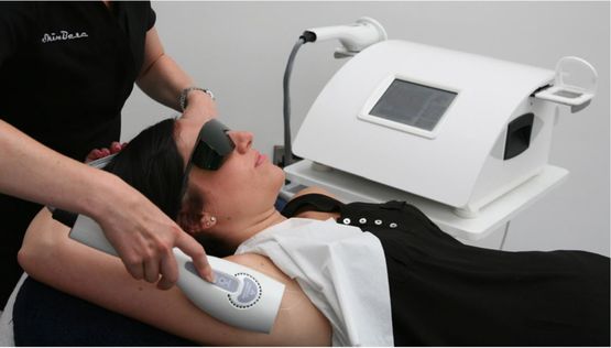 IPL Treatment image